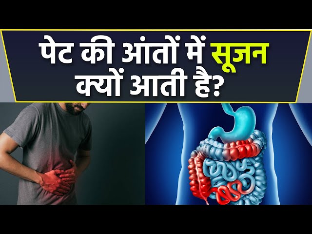 आंतों में सूजन