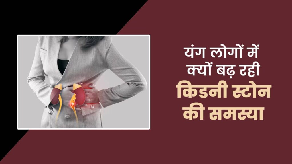 किडनी स्टोन